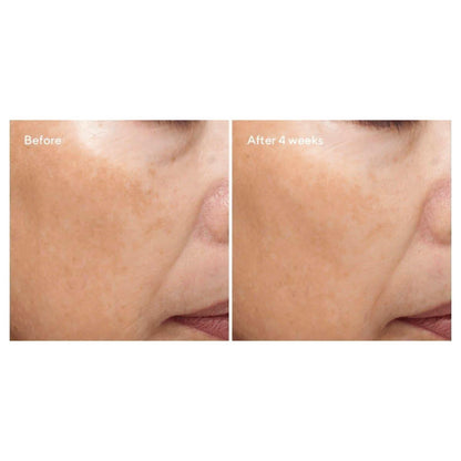 Anti Aging Vitamin C Day Moisturizer Cream