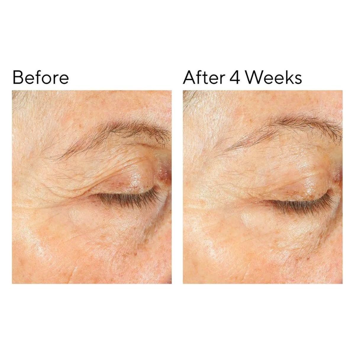 Nourishing Rich Face Moisturiser for Dry Sensitive Skin