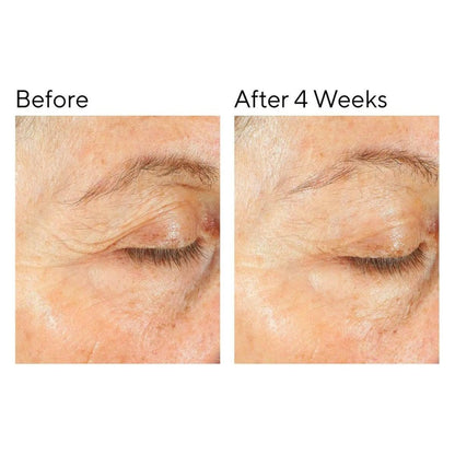 Nourishing Rich Face Moisturiser for Dry Sensitive Skin