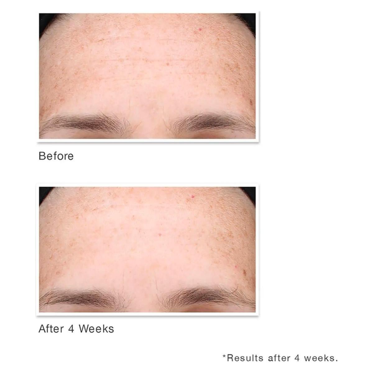 Nourishing Face Oil for Glowing Skin and Anti Aging