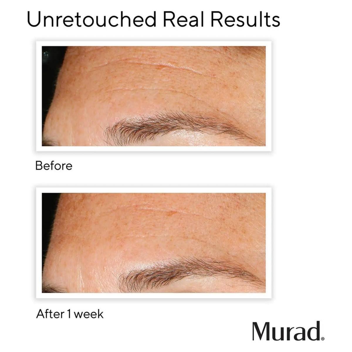 Daily Exfoliating Peel for Brighter Skin