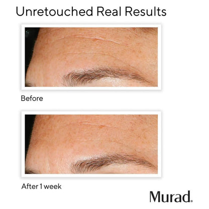 Daily Exfoliating Peel for Brighter Skin