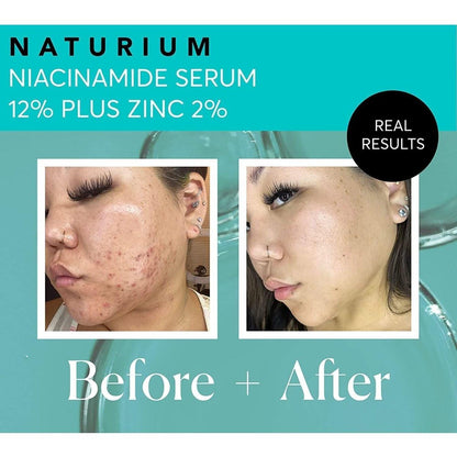 Intensive Niacinamide Serum 12% for Glowing Skin