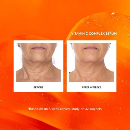 Powerful Vitamin C Face Serum - Large 60ml Anti Aging