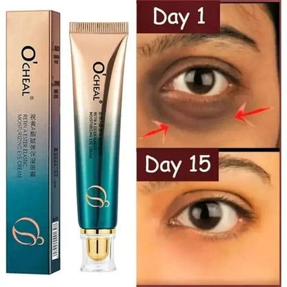 Anti Aging Eye Cream Moisturizer 30ml