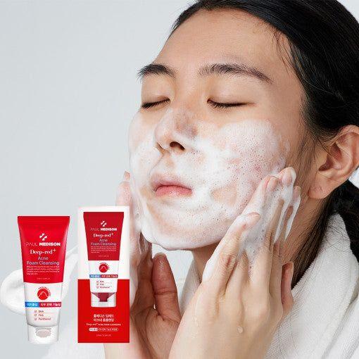 Effective Red Acne Face Wash 155ml | Soothing Acne Skin Care