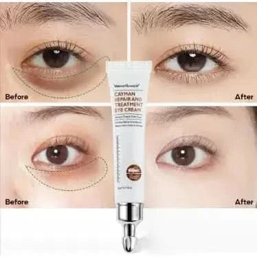 Anti Aging Eye Cream - Moisturizing Collagen Eye Treatment - Mycosmeticslondon