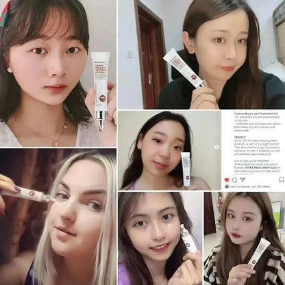 Anti Aging Eye Cream - Moisturizing Collagen Eye Treatment