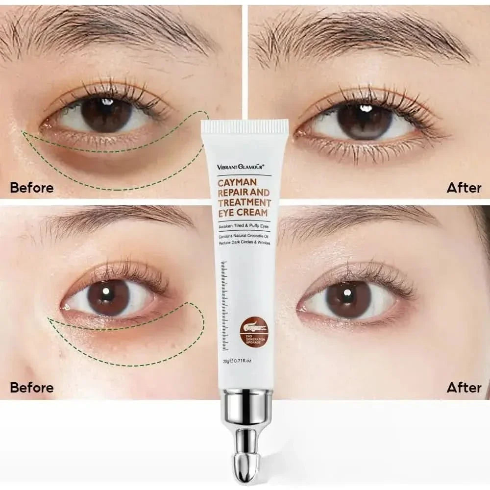 Anti Aging Eye Cream - Moisturizing Collagen Eye Treatment