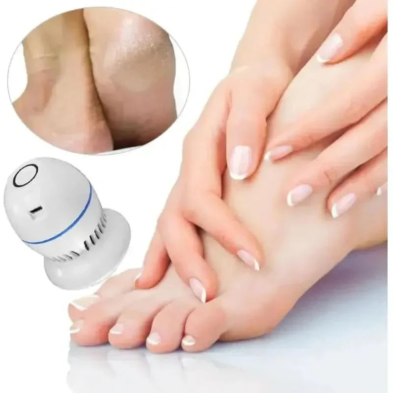 Compact Electric Foot Callus Remover
