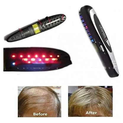 Thickening Hair Regrowth Comb | Electric Stimulating Hair Loss Treatment