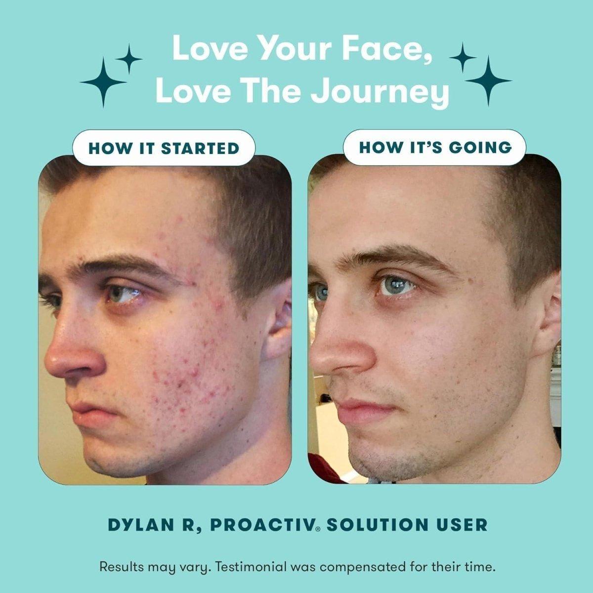 Effective 3-Step Acne Fighter Kit
