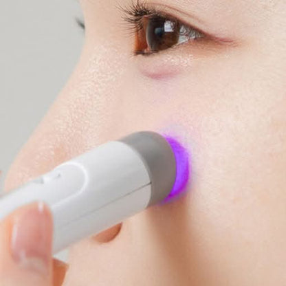 Acne Treatment LED Blue Light Spot Pen