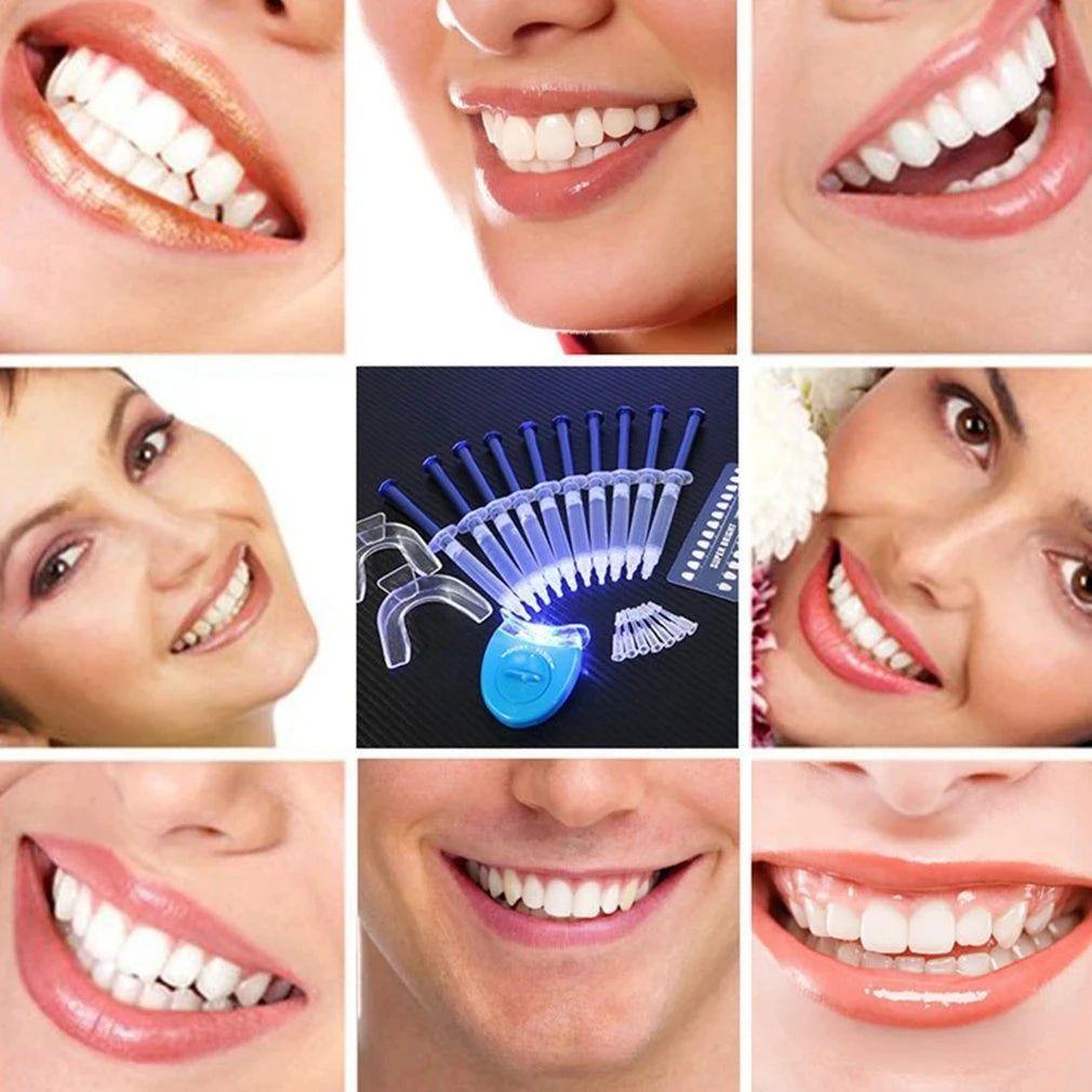 Advanced At-Home Teeth Whitening Kit