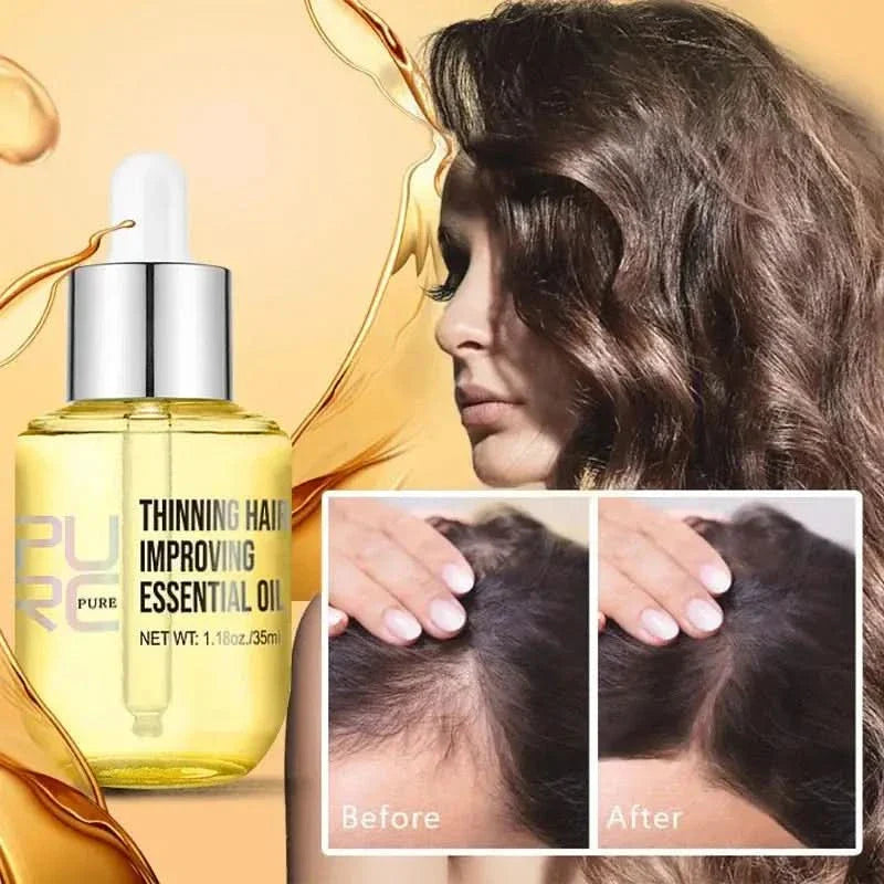 Natural Ginger Hair Regrowth Oil