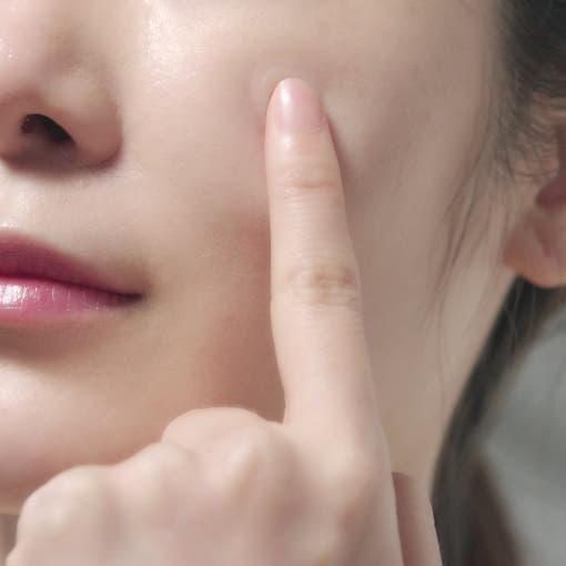 Gentle Hydrocolloid Acne Patches for Fast Spot Healing