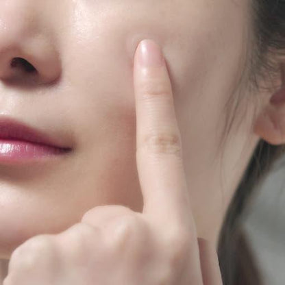 Gentle Clear Acne Patches for Fast Spot Healing