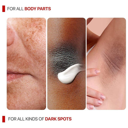 Dark Spot Removal Cream - 55ml | Skin Brightening Moisturizer