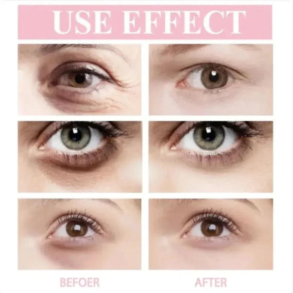 Anti Aging Eye Cream Stick - 9g