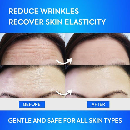 Smooth Forehead Wrinkle Stickers - 12 Pack