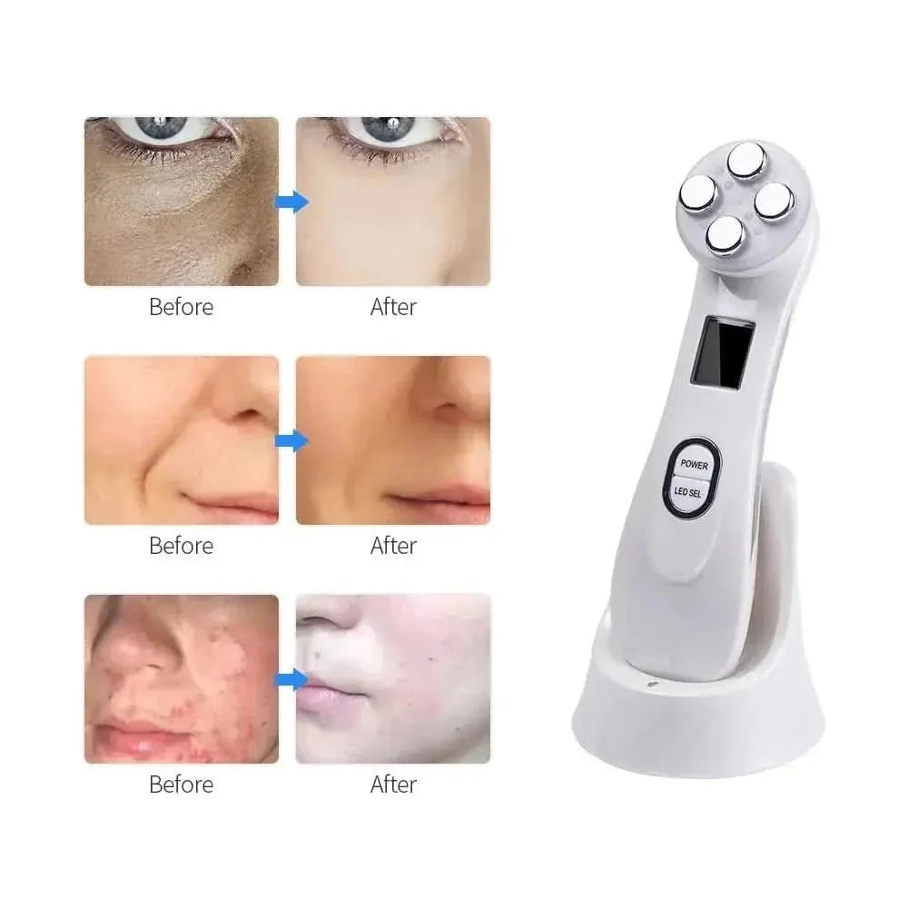 Facial Rejuvenation Massage Tool