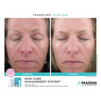 Daily Skin Care Set for Normal Skin with SPF 33