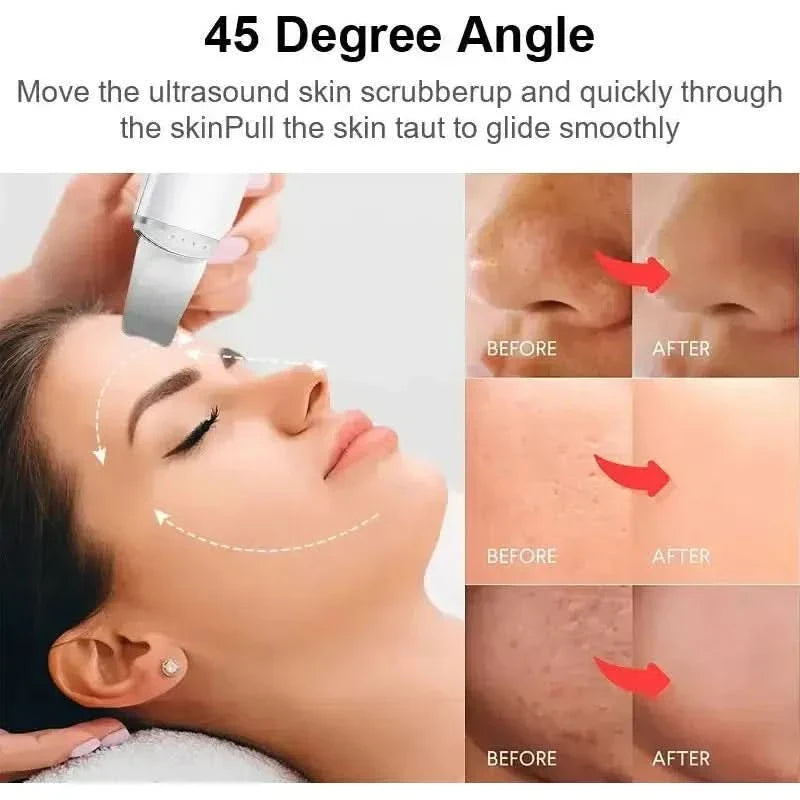Gentle Facial Cleanser Blackhead Remover