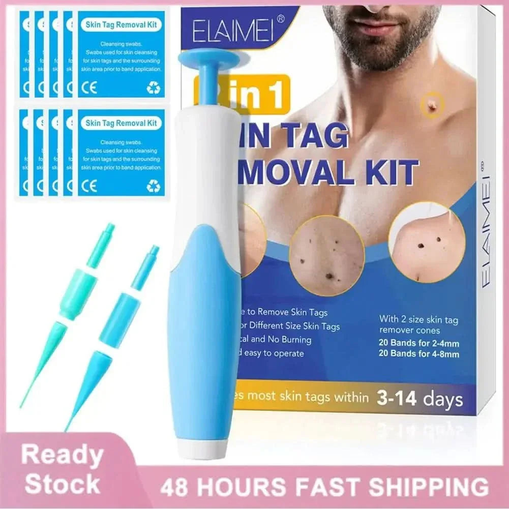 Easy At Home Skin Tag Removal Tool Kit - Mycosmeticslondon