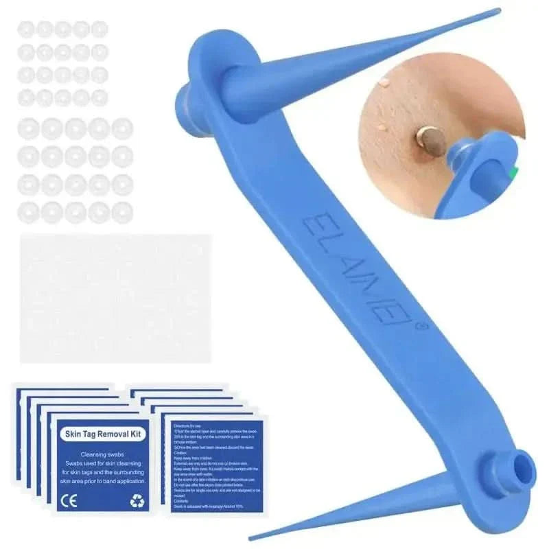 Easy At Home Skin Tag Removal Tool Kit