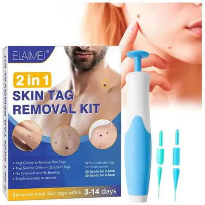 Easy At Home Skin Tag Removal Tool Kit