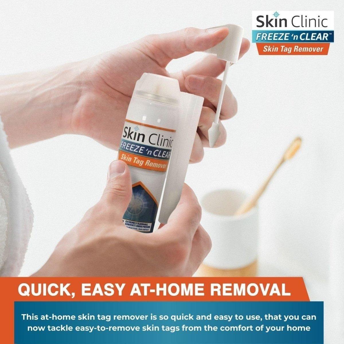 Easy Skin Tag Remover Kit with 8 Applications