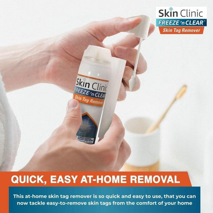 Easy Skin Tag Remover Kit with 8 Applications