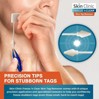 Easy Skin Tag Remover Kit with 8 Applications