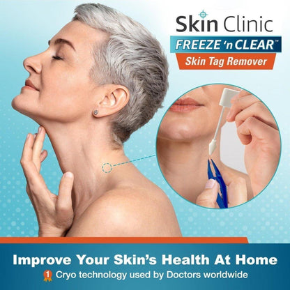Easy Skin Tag Remover Kit with 8 Applications