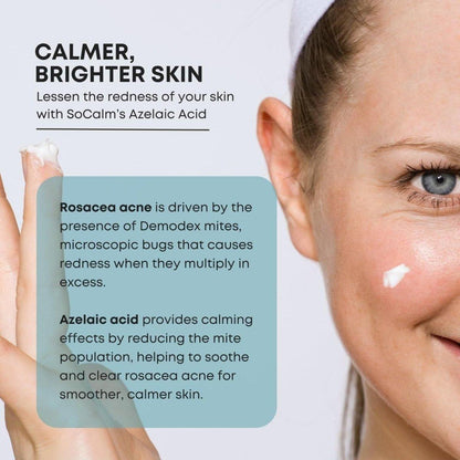 Gentle Azelaic Acid Face Cream for Rosacea & Acne