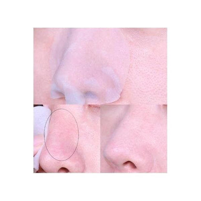 Effective Blackhead Remover Pads - 30 Count