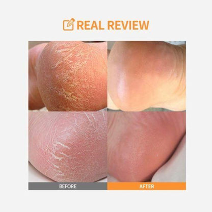 Gentle Foot Exfoliator Stick for Soft Feet Care