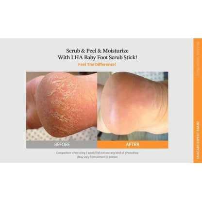 Gentle Foot Exfoliator Stick for Soft Feet Care