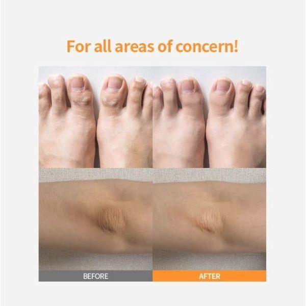 Gentle Foot Exfoliator Stick for Soft Feet Care