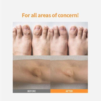 Gentle Foot Exfoliator Stick for Soft Feet Care