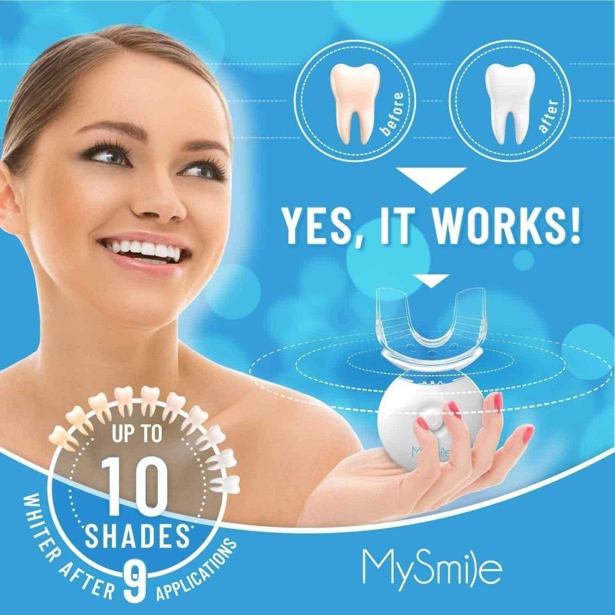 Advanced At Home Teeth Whitening Kit with LED