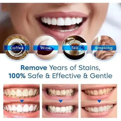 Fast Teeth Whitening Pen for a Bright Smile