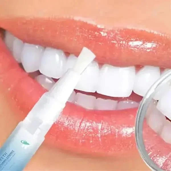 Fast Teeth Whitening Pen for a Bright Smile - Mycosmeticslondon