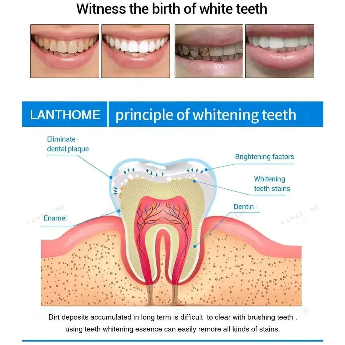 Fast Teeth Whitening Pen for a Bright Smile