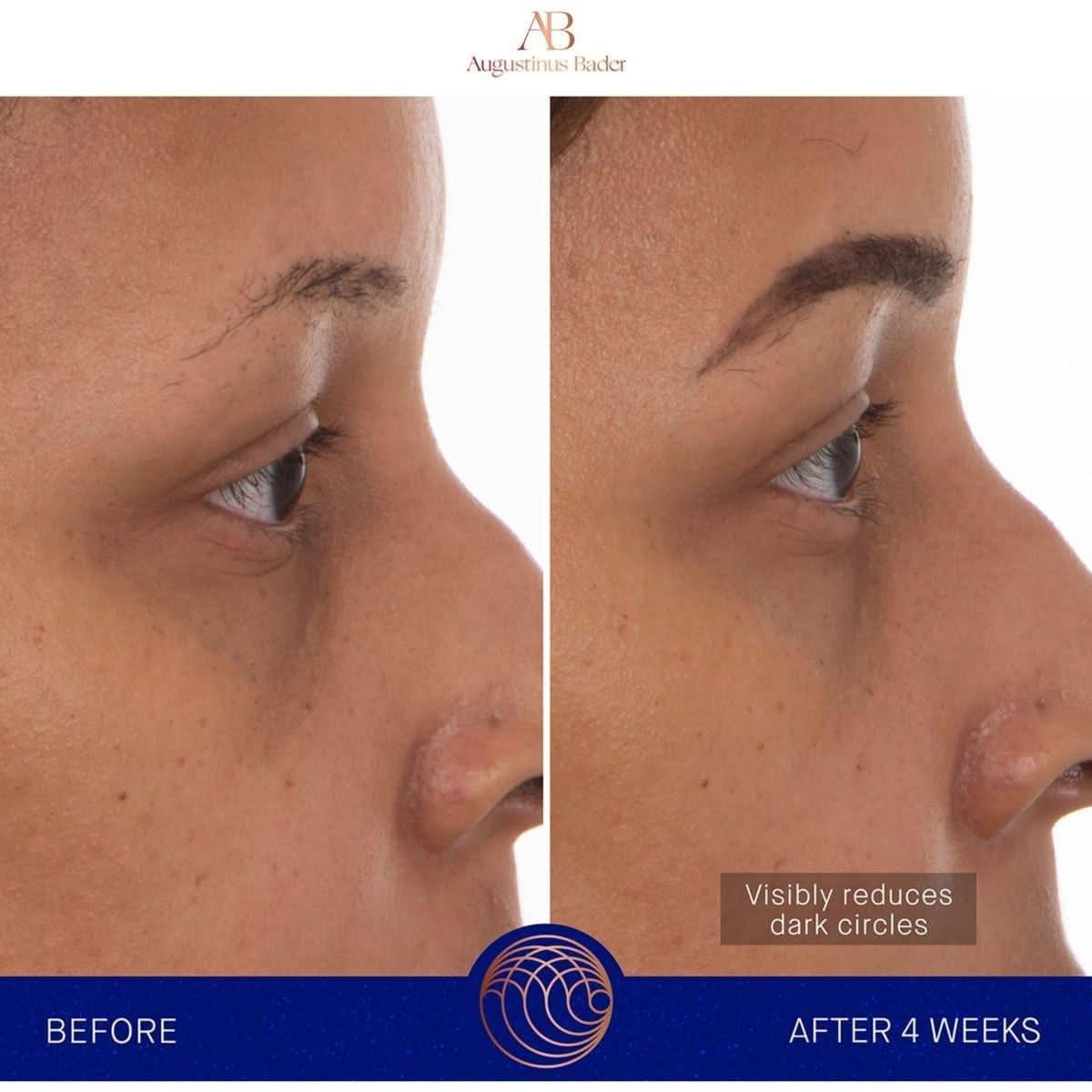 Rejuvenating Hydrogel Eye Masks with Advanced Skincare Technology