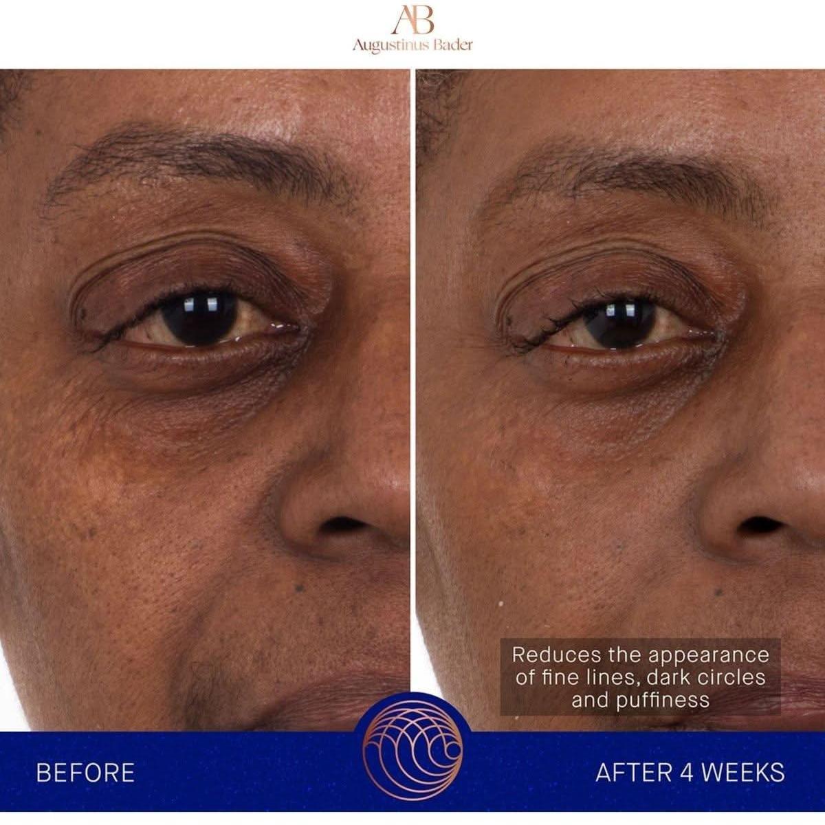 Rejuvenating Hydrogel Eye Masks with Advanced Skincare Technology
