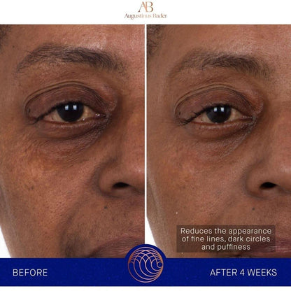 Rejuvenating Hydrogel Eye Masks with Advanced Skincare Technology