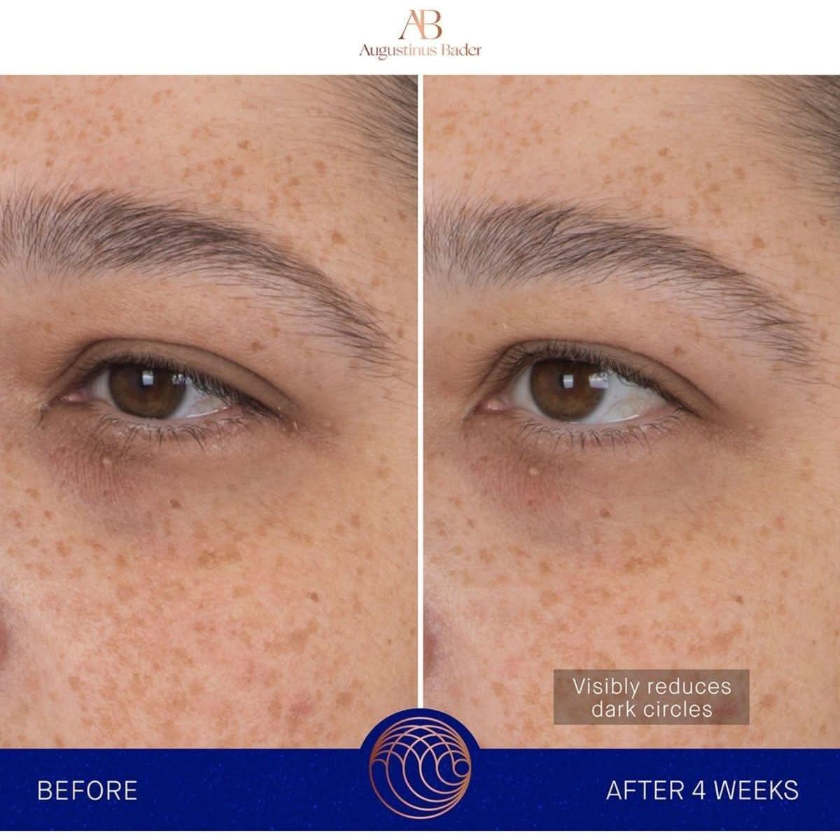 Rejuvenating Hydrogel Eye Masks with Advanced Skincare Technology