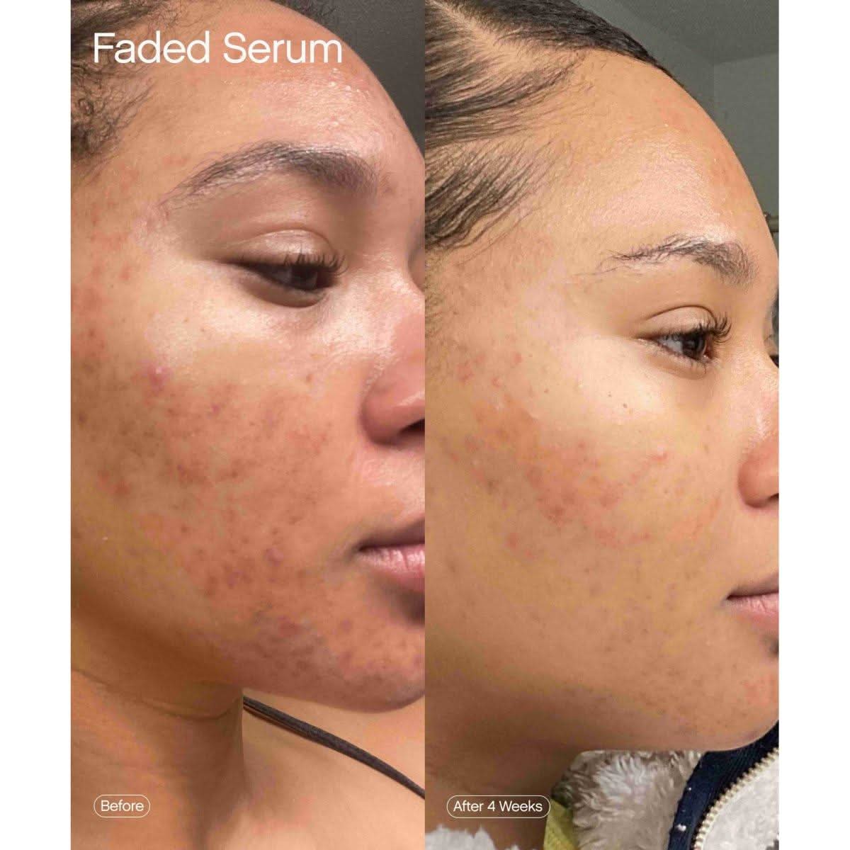 Natural Glow Hydrating Skincare Set