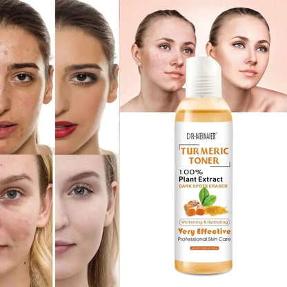 Natural Turmeric Face Toner for Acne & Glowing Skin